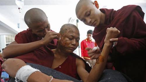A bloody victim of the violence at Burma copper mine